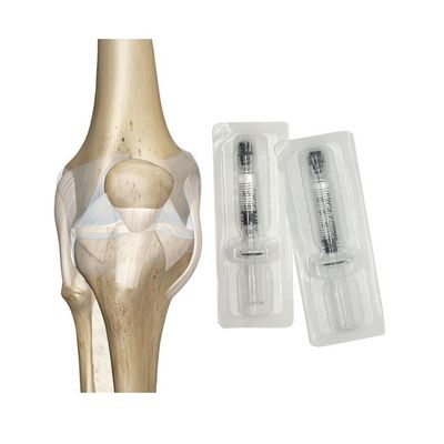 Osteoartrite Gel ialuronico Iniezione Iniezione ialuronica Ginocchio Lubrificazione del ginocchio