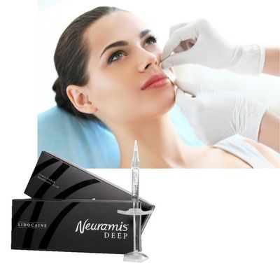 1 ml di Neuramis Dermal Filler per trattamenti da superficiale a profondo