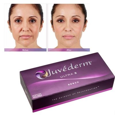 Acido ialuronico gel di riempimento del viso Juvederm pelle liscia e impeccabile