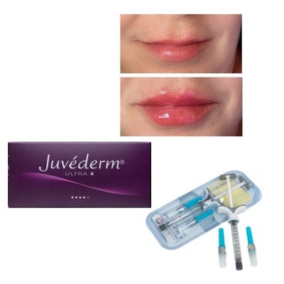 6-9 mesi Durazione Gel di riempimento cutaneo Juvederm Acquisto online e in negozio
