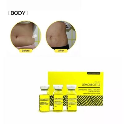 Vendita Lemon Bottle Fat Dissolver 5X10ml Box Soluzione Per Perdita Di Peso Online