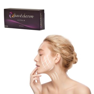 Gel di riempimento cutaneo con acido ialuronico per il riempimento delle rughe - Juvederm Solution