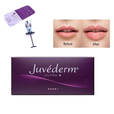 Allergan Juvederm Dermal Filler Injection Ultra4 con Lido