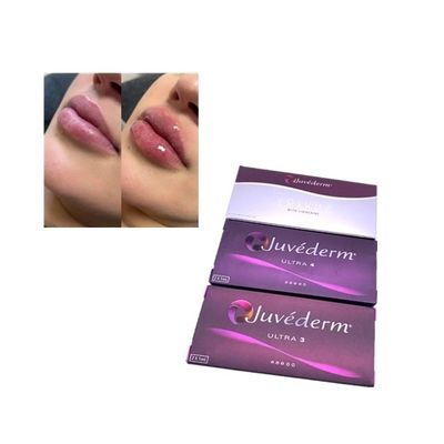 Iniezione Juvederm Voluma Cross Linked Dermal Filler