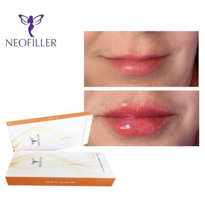24 mg/ ml 2 ml Siringa Derm Hyaluronic Acid Dermal Filler