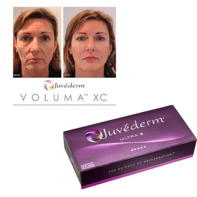 Filler dermico Juvederm in gel con concentrazione 20mg/ml, progettato per chirurgia plastica e trattamenti di riduzione delle rughe