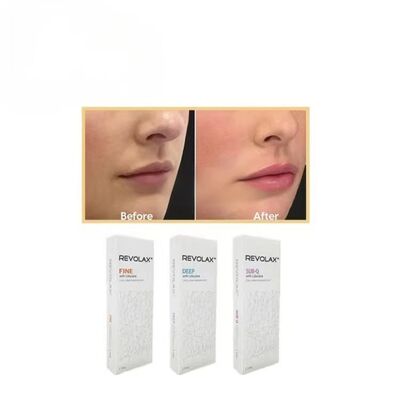 Filler dermico Revolax Fine Deep Sub-Q con gel liscio ed elastico per il ripristino naturale del volume del viso