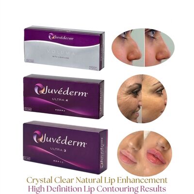 Volume della siringa 2 1 ml per scatola Juvederm Voluma Filler Safety Facial Contouring Injectable Dermal Filler per aumento del volume
