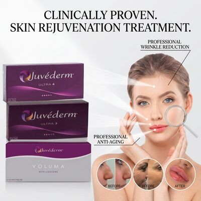 Filler Juvederm Ultra 3 per solchi naso-labiali Acido Ialuronico Filler Dermico per Levigare le Linee del Sorriso 24mg/ml