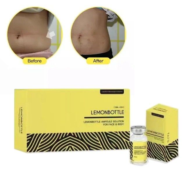 Soluzione in bottiglia ad alta concentrazione di limone per iniezioni di scioglimento dei grassi 5 flaconcini X 10 ml corpo intero