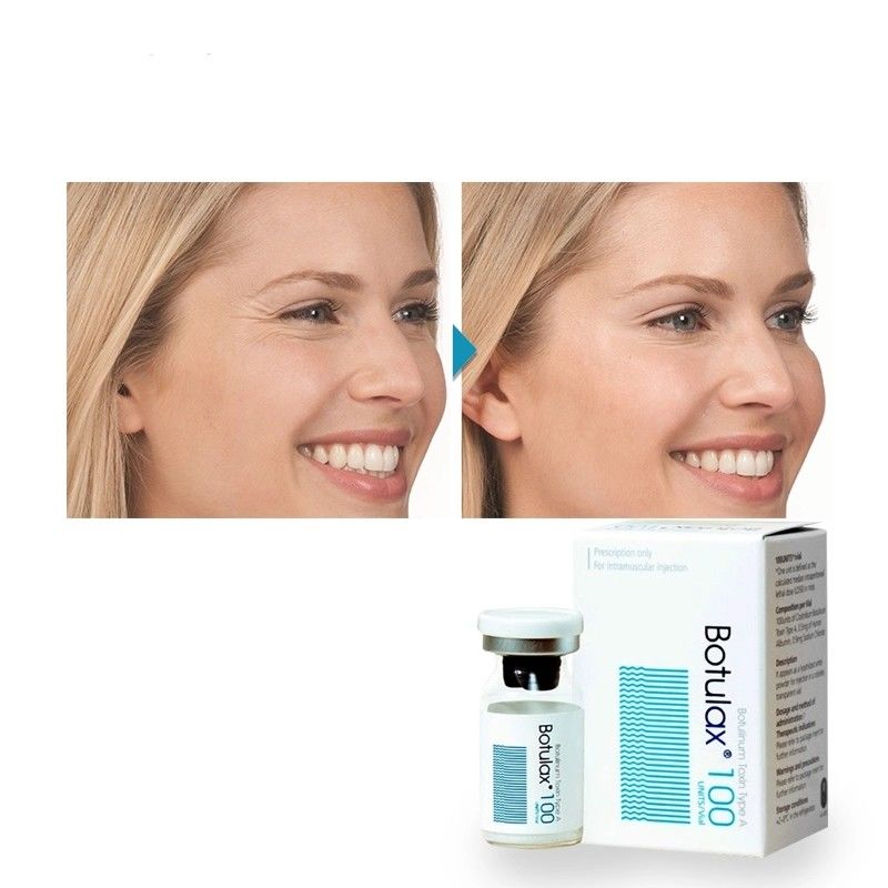 Allergano di tipo A Rilassamento muscolare Botulax Antirughe Faccia e spalle sottili