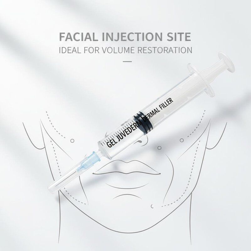 Gel Juvederm Dermal Filler 1ml Siringa Sito di iniezione facciale Ideale per i trattamenti di ringiovanimento facciale e ripristino del volume